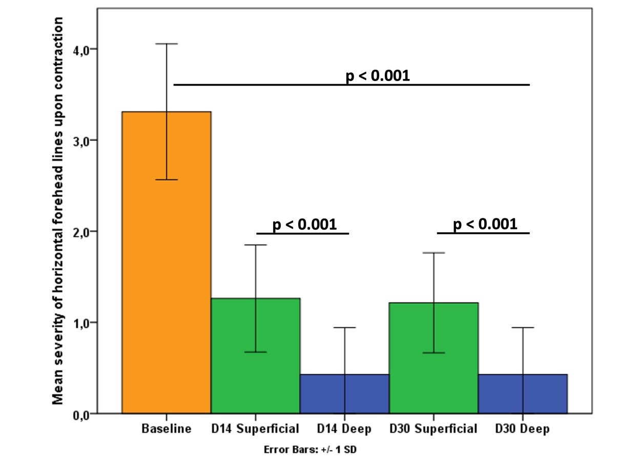 Bar chart of forehead line severity on contraction: baseline about 3.3, superficial about 1.2, deep about 0.4 at both day 14 and day 30